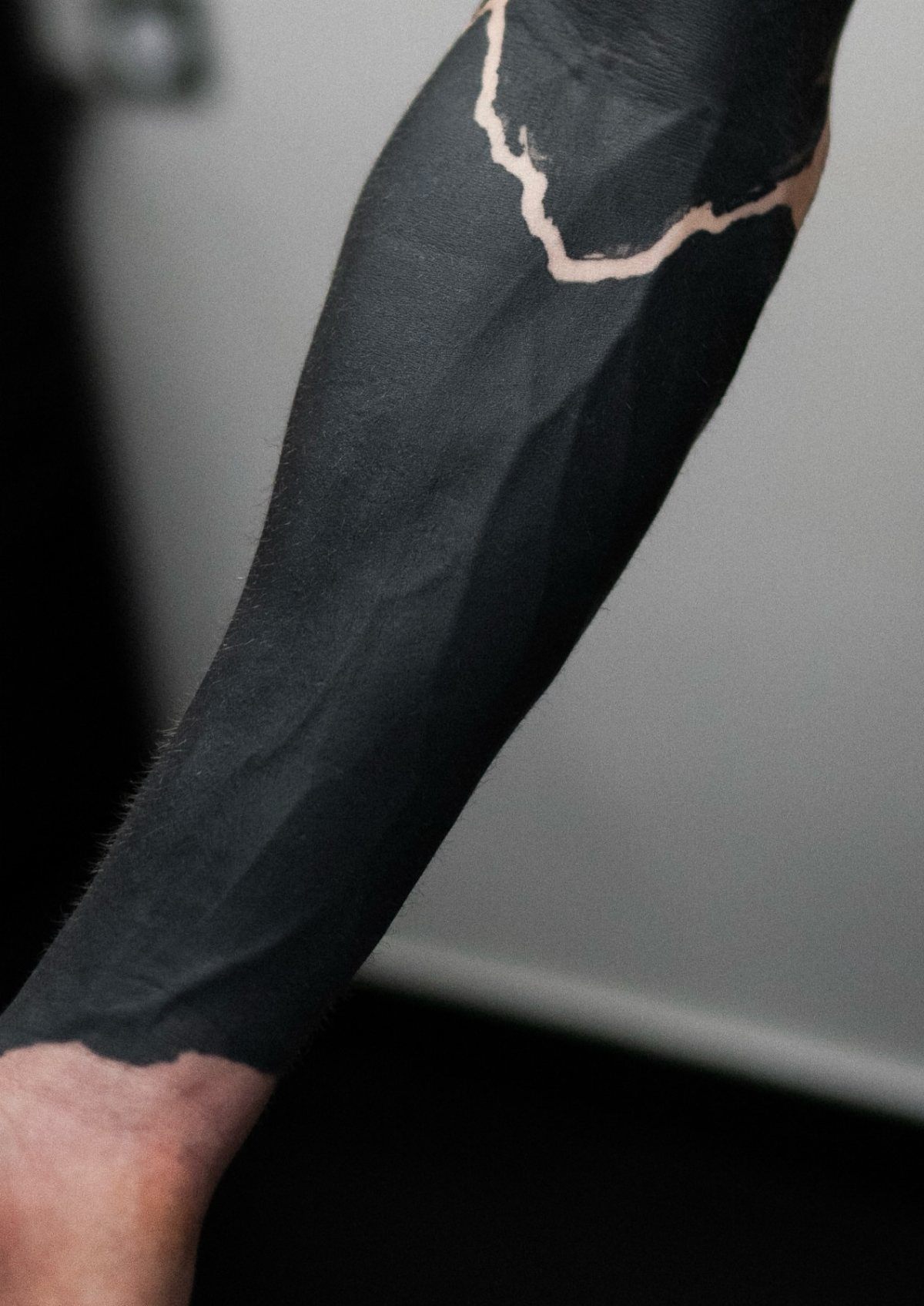 Arm with a solid black blackout tattoo and a jagged skin gap.