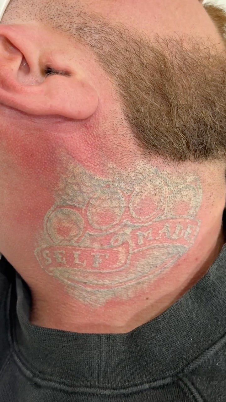 Faded white ink tattoo on a person's neck showing signs of aging and discoloration.